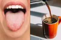 این نشانه روی زبان می‌گوید نباید قهوه بنوشید؛ رنگ‌های مختلف زبان نشانه چیست؟