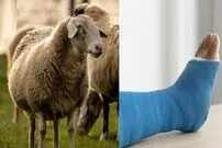 دانشمندان از «پشم» ماده‌ای برای ترمیم استخوان ساخته‌اند