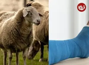دانشمندان از «پشم» ماده‌ای برای ترمیم استخوان ساخته‌اند