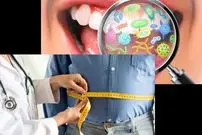 میکروب‌های دهان می‌توانند کلید پیشگیری از چاقی باشند