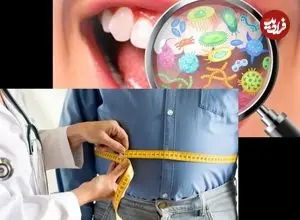 میکروب‌های دهان می‌توانند کلید پیشگیری از چاقی باشند