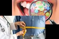 میکروب‌های دهان می‌توانند کلید پیشگیری از چاقی باشند
