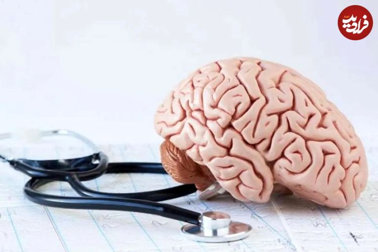 تشخیص آلزایمر تنها در سه دقیقه