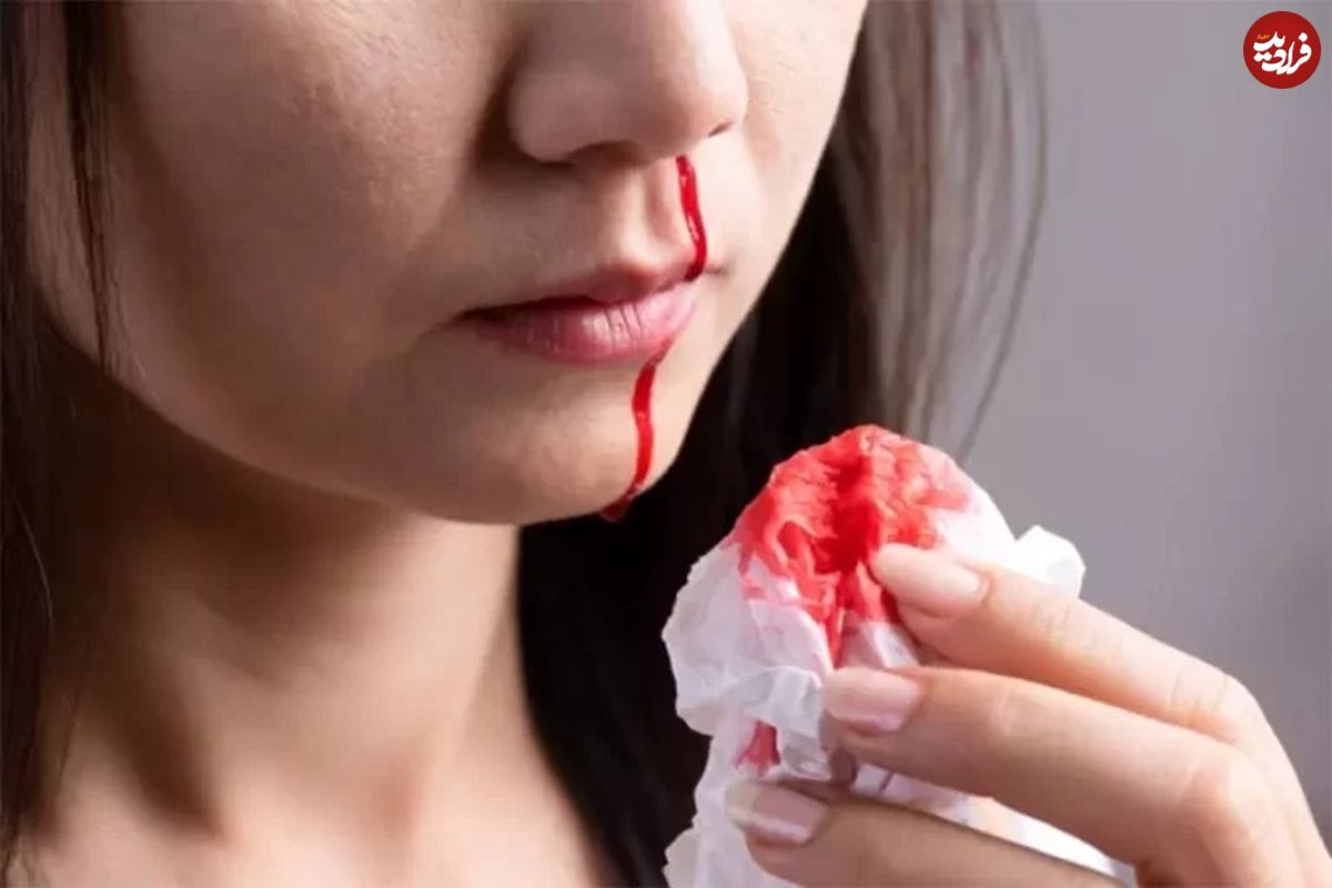 چرا «خونریزی بینی» اتفاق میافتد؟