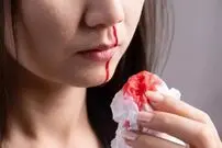 چرا «خونریزی بینی» اتفاق می‌افتد؟