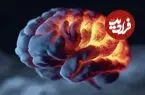 روی تاریک سلول‌های محافظ مغز شناسایی شد!