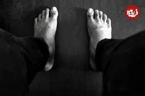 عکس| معلولیت خود خواسته برای گرفتن سهمیه پزشکی/ ماجرای این جوان ۲۰ ساله را بخوانید