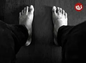 عکس| معلولیت خود خواسته برای گرفتن سهمیه پزشکی/ ماجرای این جوان ۲۰ ساله را بخوانید