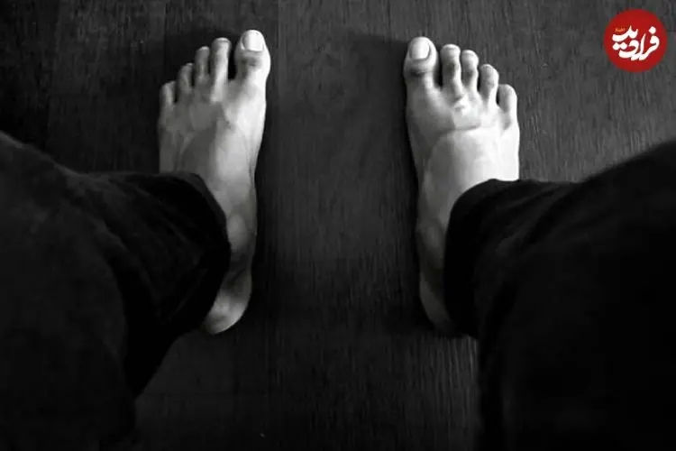 عکس| معلولیت خود خواسته برای گرفتن سهمیه پزشکی/ ماجرای این جوان ۲۰ ساله را بخوانید