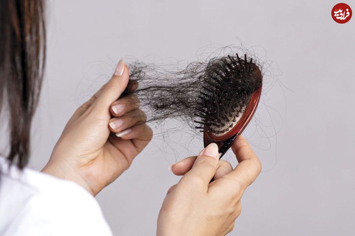 آیا می‌توان از ریزش مو جلوگیری کرد؟

