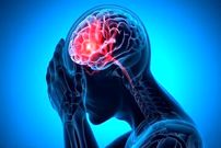 شایع‌ترین علت خونریزی مغزی را بشناسیم
