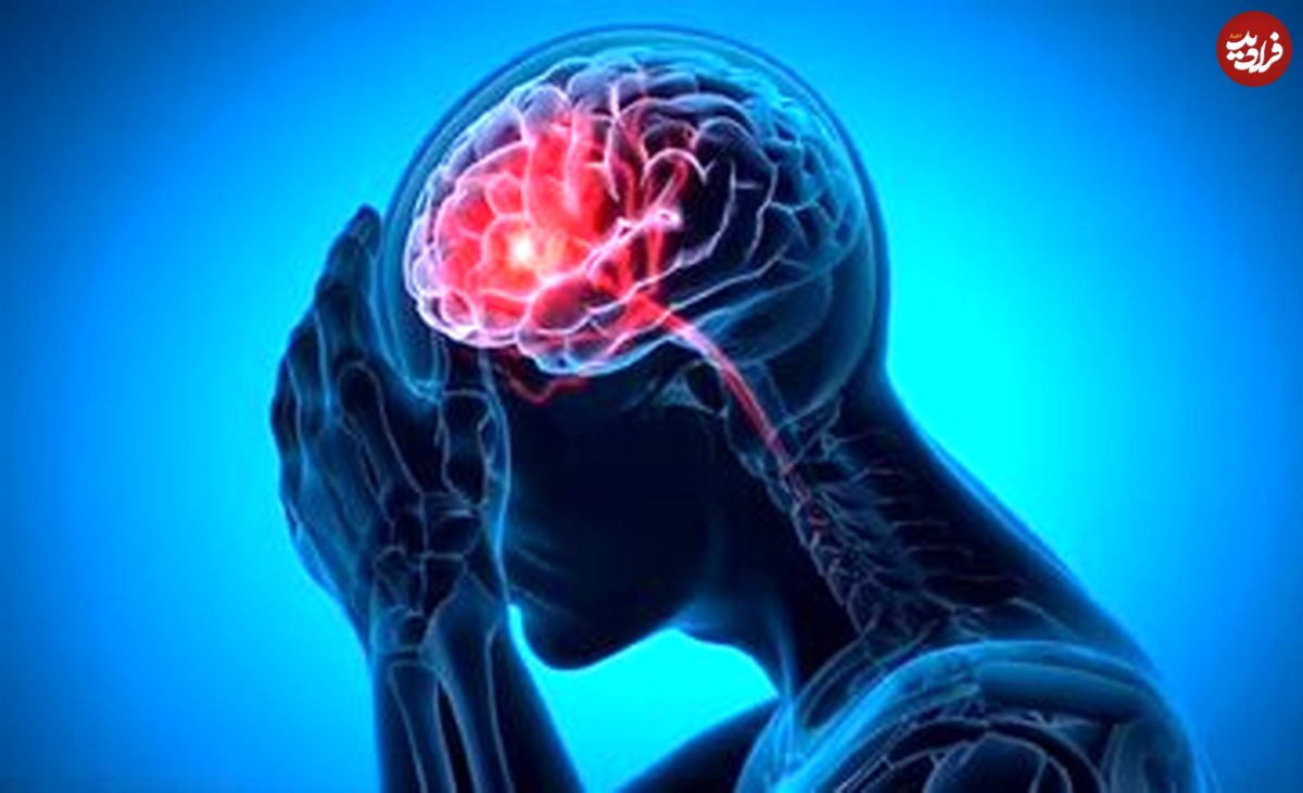 شایع‌ترین علت خونریزی مغزی را بشناسیم