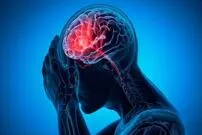 شایع‌ترین علت خونریزی مغزی را بشناسیم