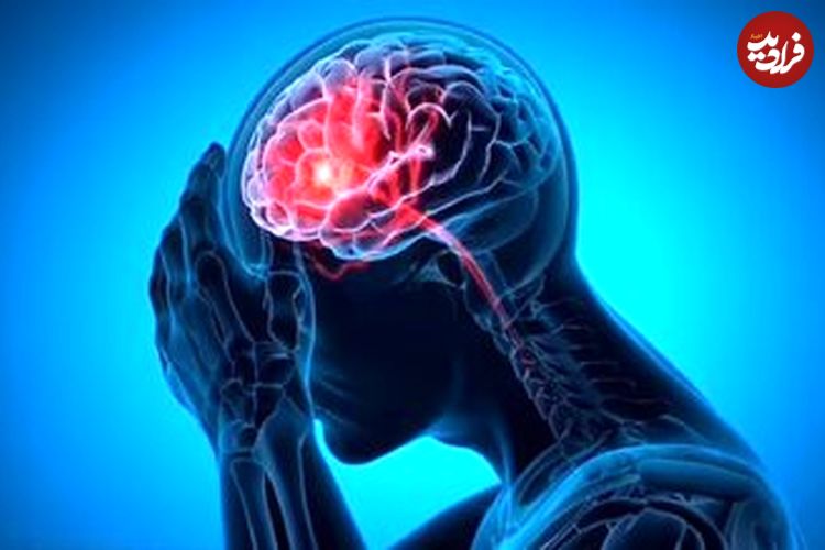 شایع‌ترین علت خونریزی مغزی را بشناسیم