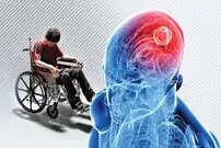 علائم خاموش بیماری ام اس چیست؟