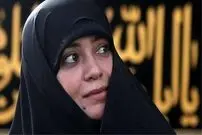 (عکس) لاغری صورت الهام چرخنده و دلیل آن