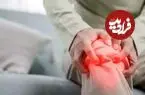 بهترین ادویه برای کاهش درد مفاصل؛ چرا دردهای مفصلی در پاییز بیشتر می‌شوند؟ راهکار