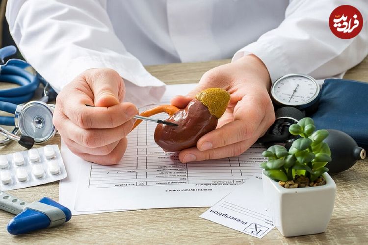با این توصیه‌ها از شر سنگ کلیه برای همیشه راحت می شوید