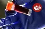 کدام گروه خونی بیشتر در معرض سکتۀ مغزی است؟