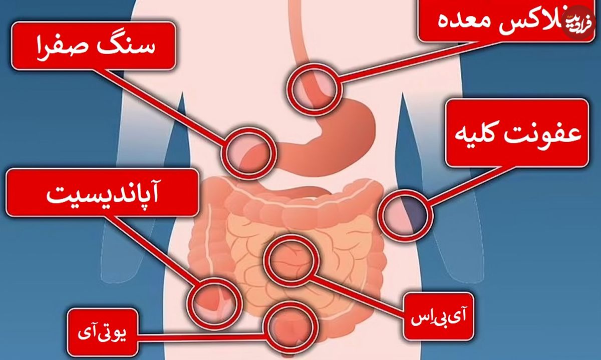 درد هر قسمت از شکم نشان دهنده چه مشکلی است؟