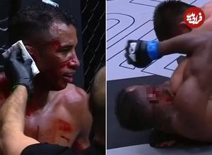 (ویدیو) ترکیدن گوش مبارز MMA در اثر ضربه مشت حریف که به مبارزه پایان داد