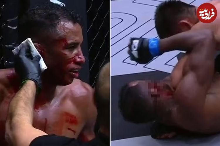 (ویدیو) ترکیدن گوش مبارز MMA در اثر ضربه مشت حریف که به مبارزه پایان داد