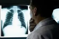 ۲۰  واقعیت جالب درباره «اشعه ایکس»