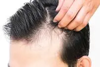 چرا موها ناگهان بیشتر از همیشه می ریزند؟ 6 علت مهم
