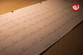 از سندرم مرگ ناگهانی بزرگسالان چه می‌دانید؟