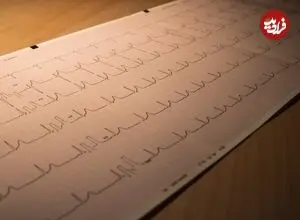 از سندرم مرگ ناگهانی بزرگسالان چه می‌دانید؟