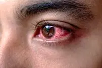 انفجار چه آسیب‌هایی می‌تواند به چشم بزند و چه کار باید کرد؟
