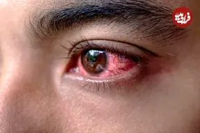 انفجار چه آسیب‌هایی می‌تواند به چشم بزند و چه کار باید کرد؟