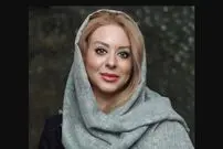 تغییر چهره شدید بازیگر زن سینما 