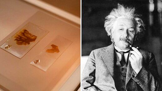 (عکس) این بلا پس از مرگ بر سر مغز اینشتین آمد!