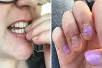 چند راهکار ساده برای ترک عادت ناخن جویدن