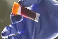 (عکس) اگر این گروه خونی را دارید، خطر سکته زودرس در کمین شماست