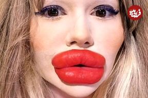 تصاویر؛ زنی که هزاران پوند خرج کرد تا بزرگترین لب دنیا را داشته باشد