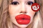 تصاویر؛ زنی که هزاران پوند خرج کرد تا بزرگترین لب دنیا را داشته باشد