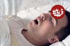 خر و پف می‌تواند نشانه‌ی نوعی نادر از سرطان باشد