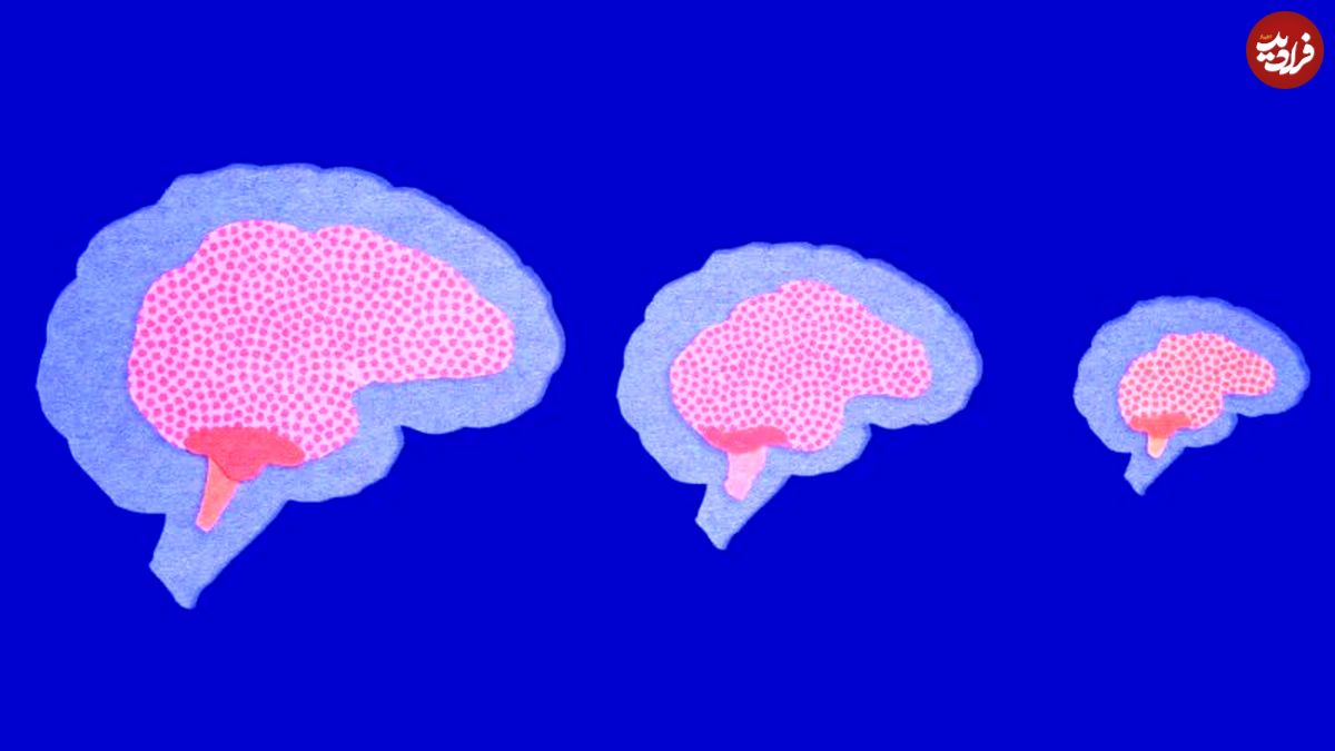 رمزگشایی از راز کوچک شدن مغز انسان در طول زمان