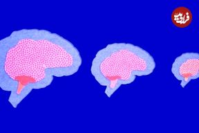 رمزگشایی از راز کوچک شدن مغز انسان در طول زمان