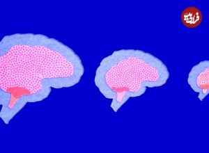 رمزگشایی از راز کوچک شدن مغز انسان در طول زمان