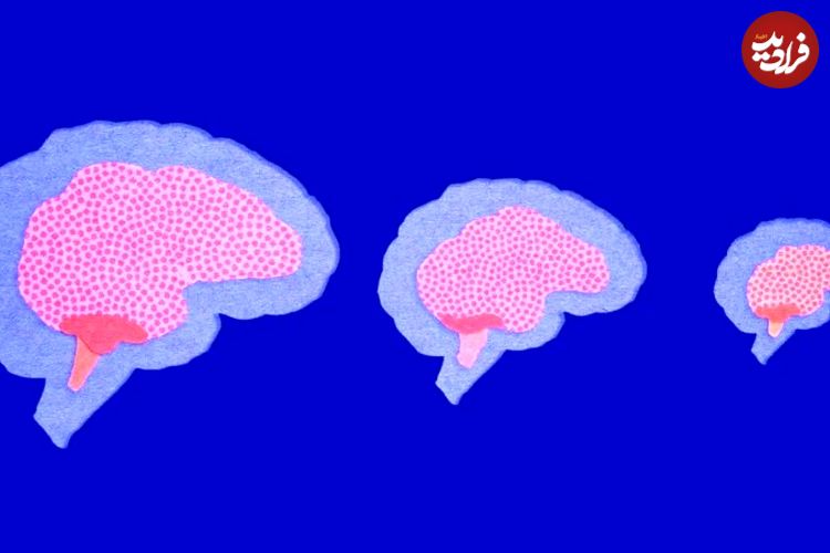 رمزگشایی از راز کوچک شدن مغز انسان در طول زمان