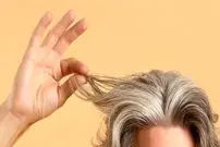 سفید شدن مو در دهه‌ی بیست زندگی؟