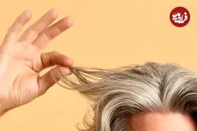 سفید شدن مو در دهه‌ی بیست زندگی؟