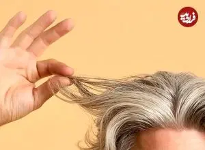 سفید شدن مو در دهه‌ی بیست زندگی؟