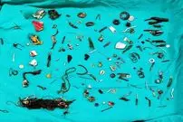 (تصاویر) محتویات شکم این مرد، همه را شگفت‌زده کرد