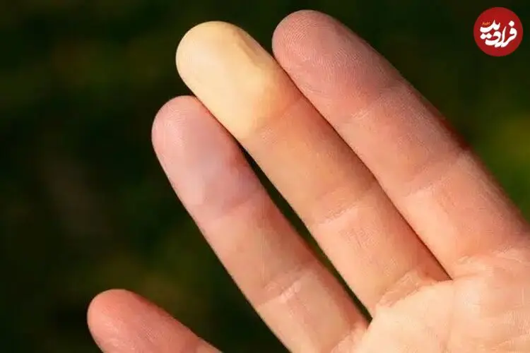 نوک انگشت شما درباره حال روحی‌تان چه می‌گوید؟