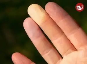 نوک انگشت شما درباره حال روحی‌تان چه می‌گوید؟