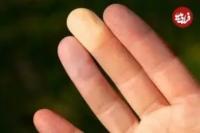 نوک انگشت شما درباره حال روحی‌تان چه می‌گوید؟